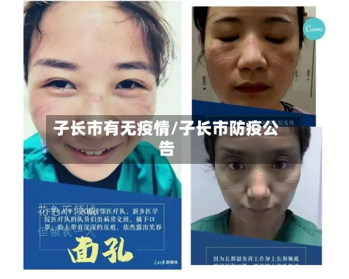 子长市有无疫情/子长市防疫公告-第3张图片